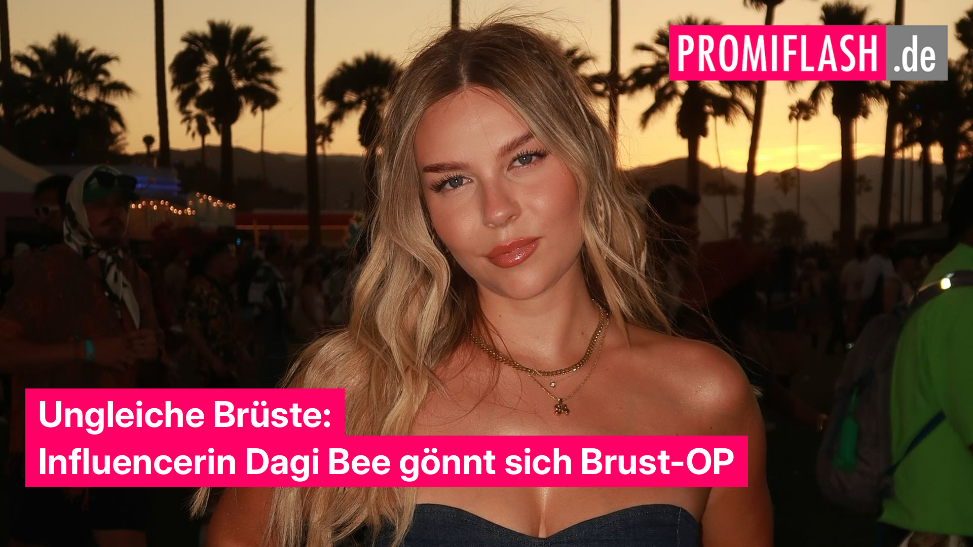 Ungleiche Brste: Influencerin Dagi Bee gnnt sich Brust-OP
