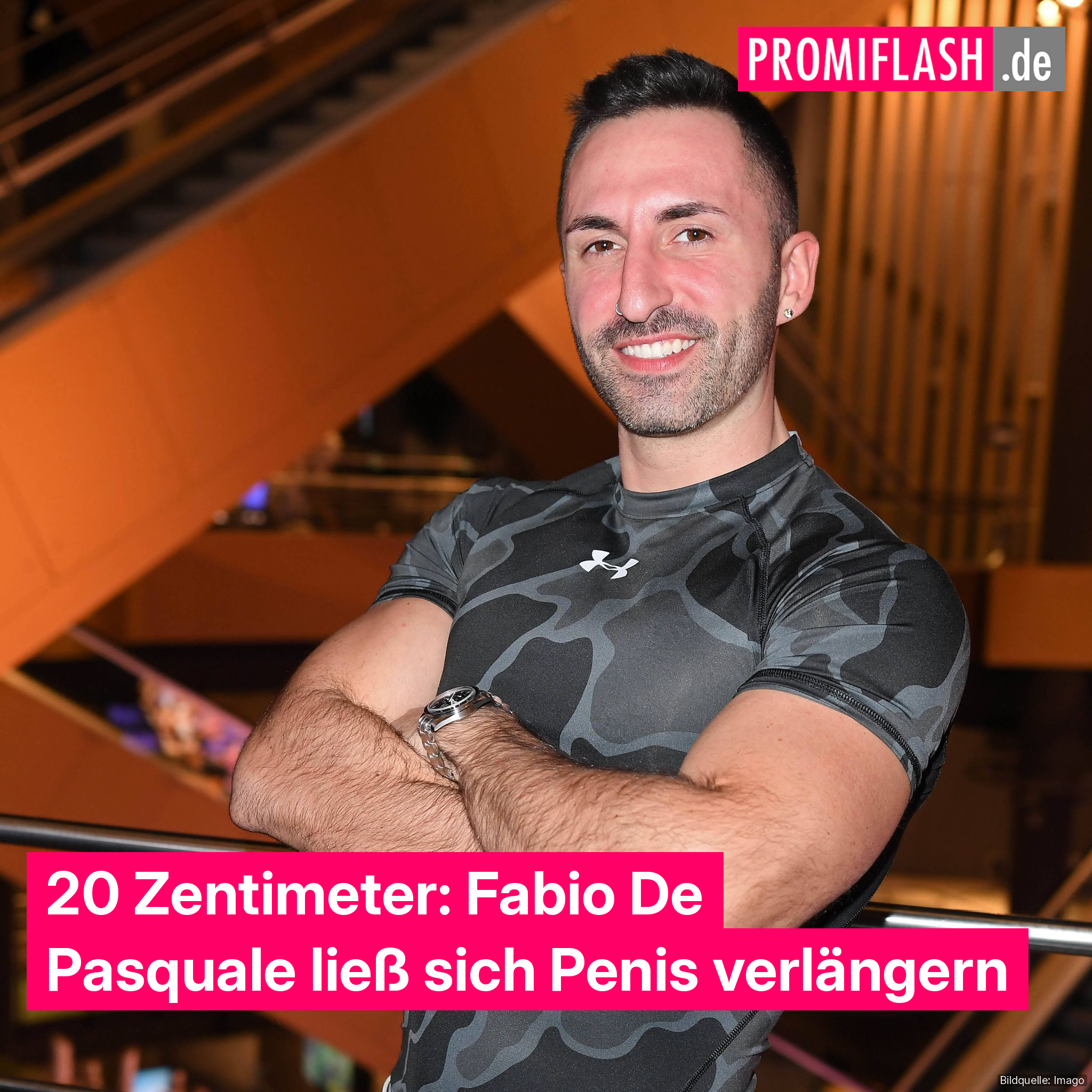 20 Zentimeter: Fabio De Pasquale lie sich Penis verlngern